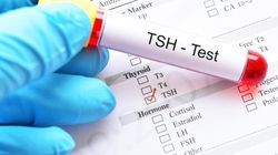 Tyreotropina - co to jest, norma, badanie
