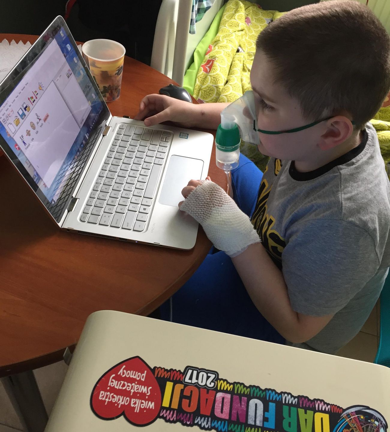 Franek jest dzieckiem z licznymi niepełnosprawnościami