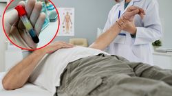 Zatkane tętnice nie bolą. Cztery ciche oznaki miażdżycy