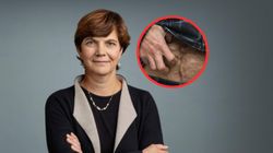 Lekarka mówi, jak rozpoznać nowotwór trzustki. Wskazuje objawy i kluczowe badania