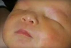 Na świat przyszedł chłopiec bez oczu