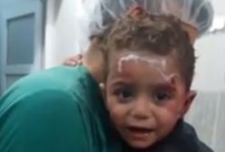 Agonia syryjskich dzieci na poruszającym wideo. Zakrwawiony chłopczyk przytula się do lekarza i nie chce go puścić