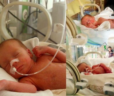 W Opolu urodziły się trojaczki. Taka ciąża zdarza się raz na 200 mln przypadków