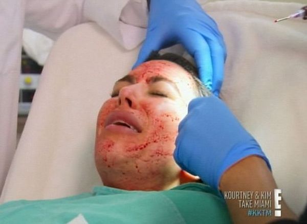 Kim Kardashian jak Krwawa Mary! Co oni robią z jej twarzą?!