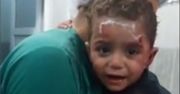 Agonia syryjskich dzieci na poruszającym wideo. Zakrwawiony chłopczyk przytula się do lekarza i nie chce go puścić