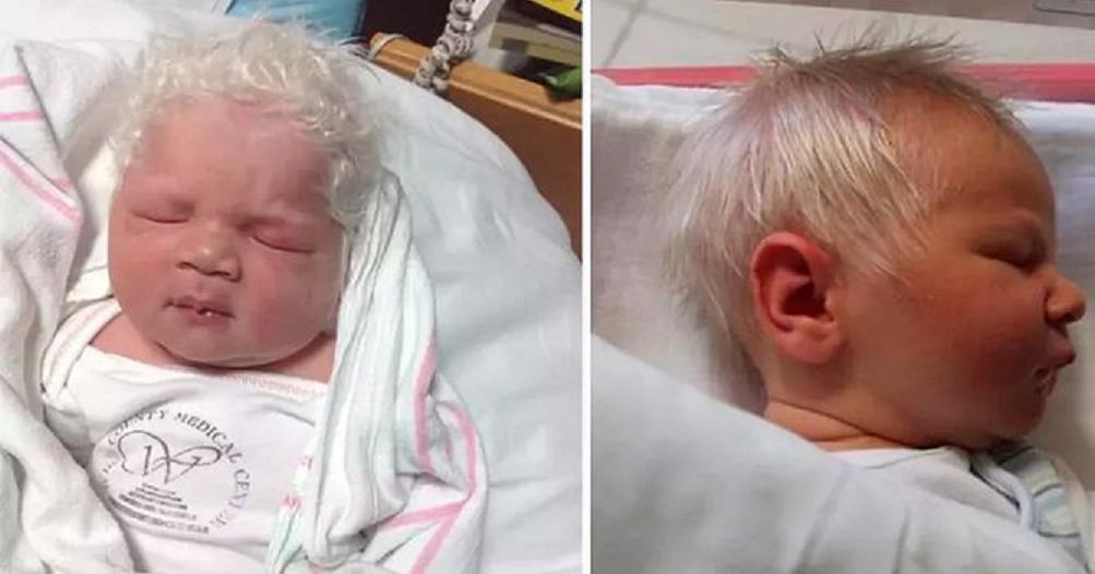 Chłopiec ze śnieżnobiałymi włosami