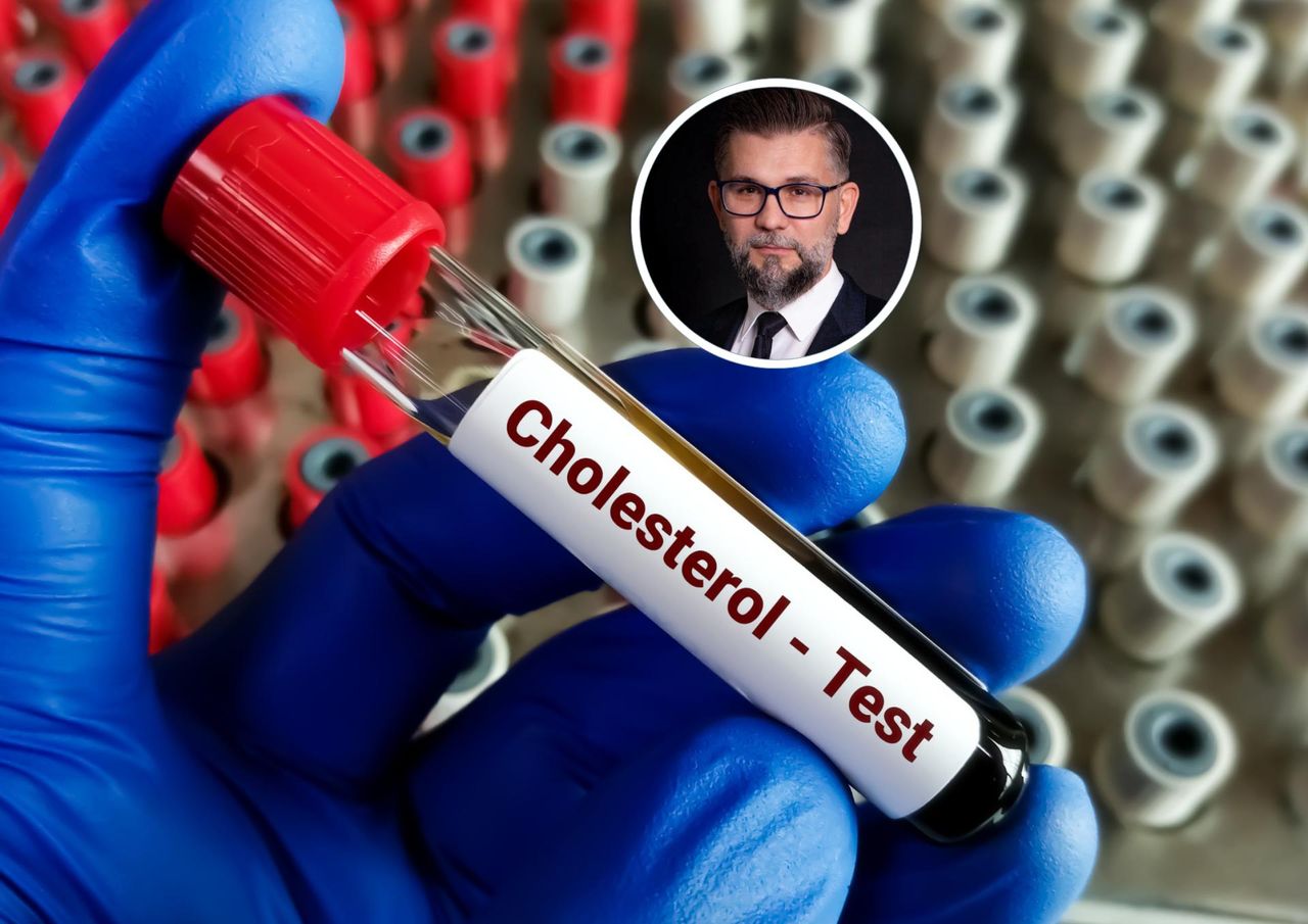 Obniży cholesterol nawet o 50 proc. "Nieodwracalna modyfikacja DNA"