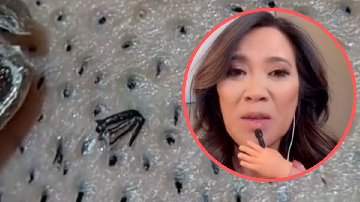 Lekarka ostrzega przed wyrywaniem wrastających włosków. Internauci są oburzeni