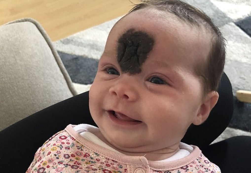 Rodzice martwią się, że dziewczynka nie odnajdzie się wśród rówieśników