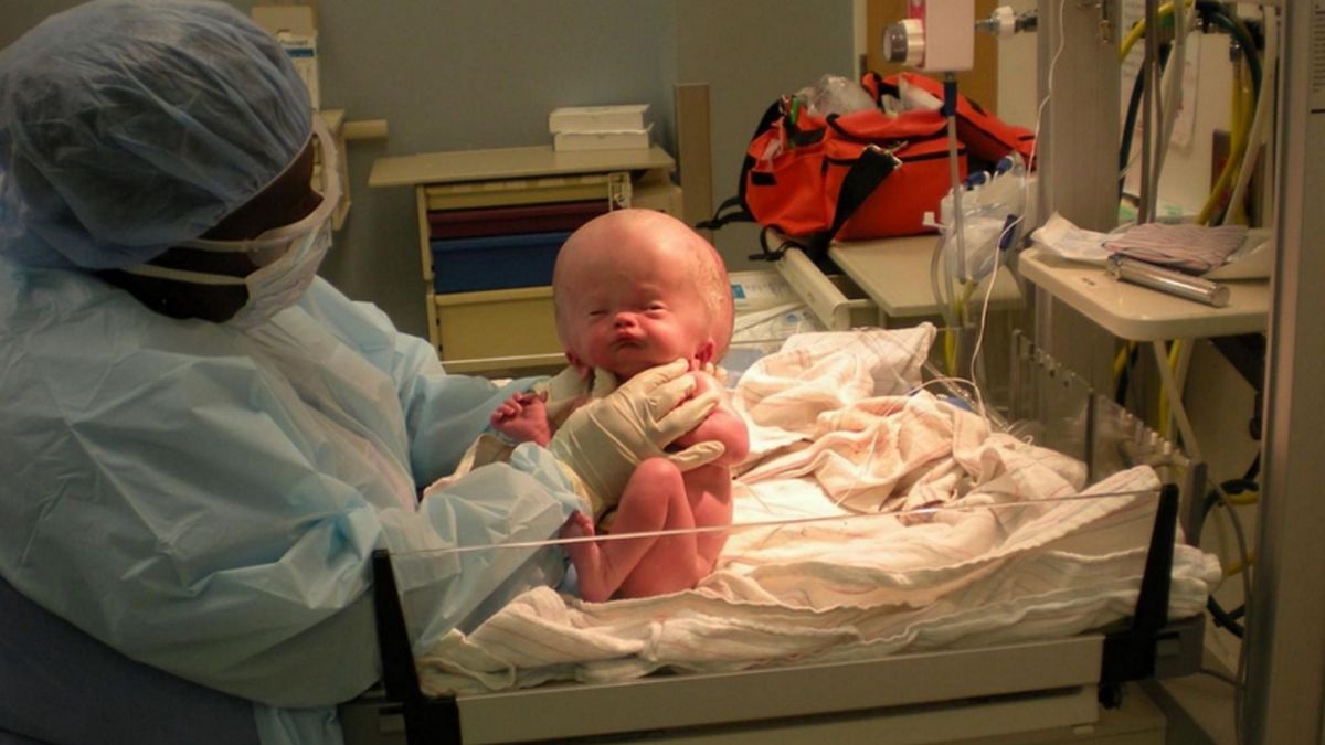 Lekarze kazali przygotować się na najgorsze. Dziś chłopiec jest pełnym życia nastolatkiem