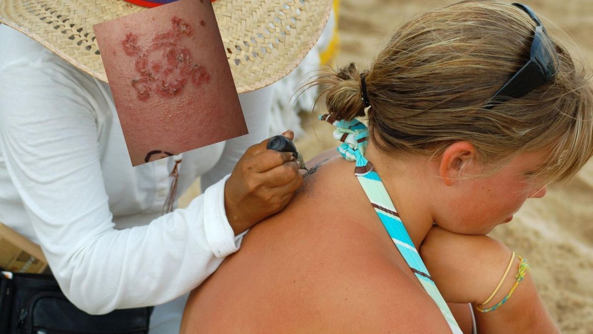 Uwaga na hennę! Ten tatuaż może wywołać groźne w skutkach powikłania. Winien jeden składnik tuszu