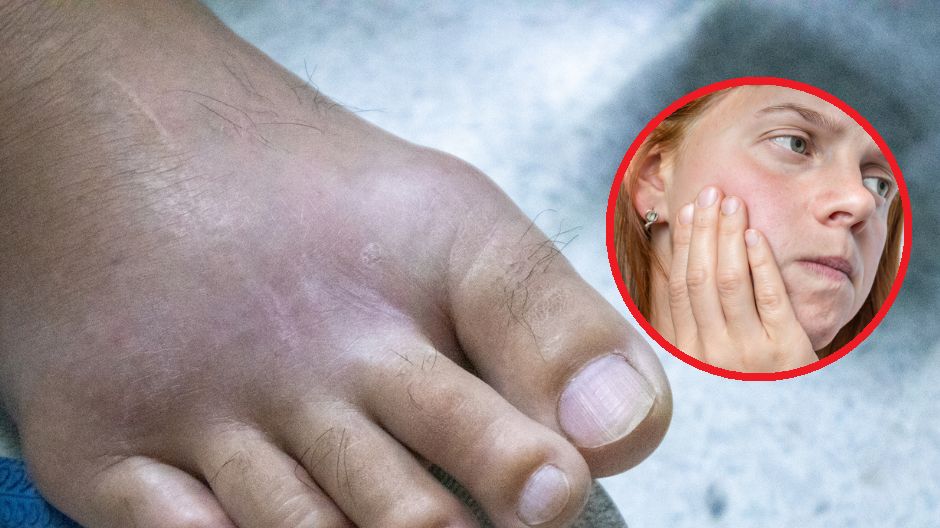 Zdrowie zębów ma wiele wspólnego ze zdrowiem stawów