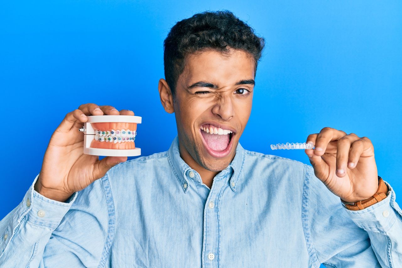 Aparat ortodontyczny samoligaturujący – charakterystyka, dobór, cena, zalety