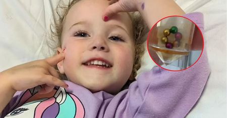 Dwulatka połknęła popularną zabawkę. Wypaliła jej fragment jelita
