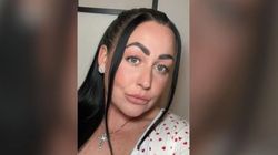 33-latka ostrzega przed skutkami opalania. "Myślałam, że to tylko przebarwienie"