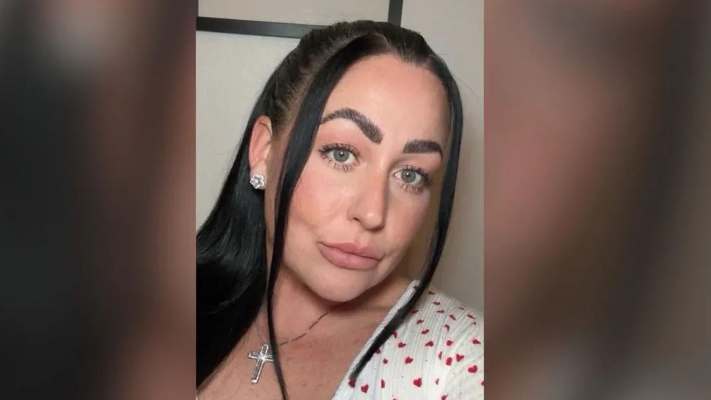 33-latka ostrzega przed skutkami opalania i solarium. "Myślałam, że to tylko przebarwienie"