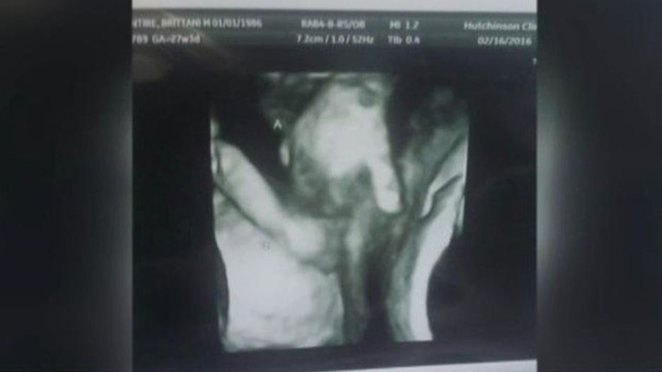 Wzruszające zdjęcie bliźniaków, które w łonie matki trzymają się za ręce