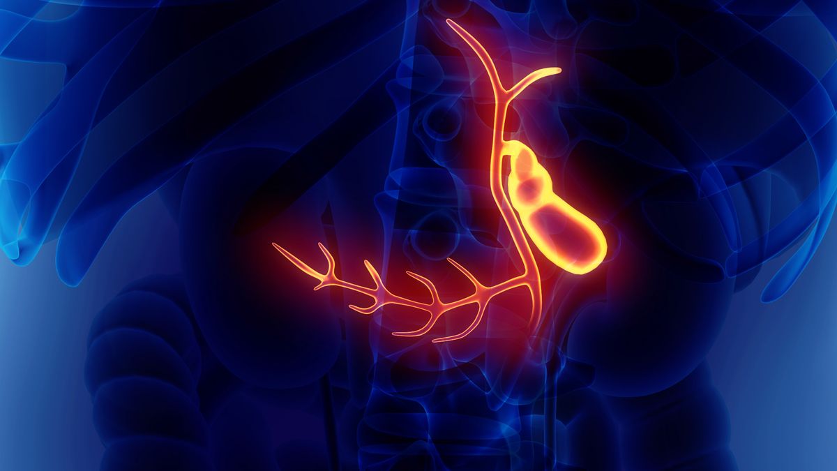 pęchrzyk żółciowy 