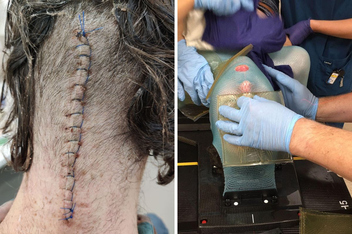 37-latek przeszedł skomplikowaną operację mózgu