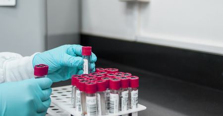 Przełom w walce z HIV. Naukowcy odkrywają metodę usuwania wirusa