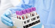 Przełom w diagnostyce alzheimera. Brytyjskie badania nad testami krwi.