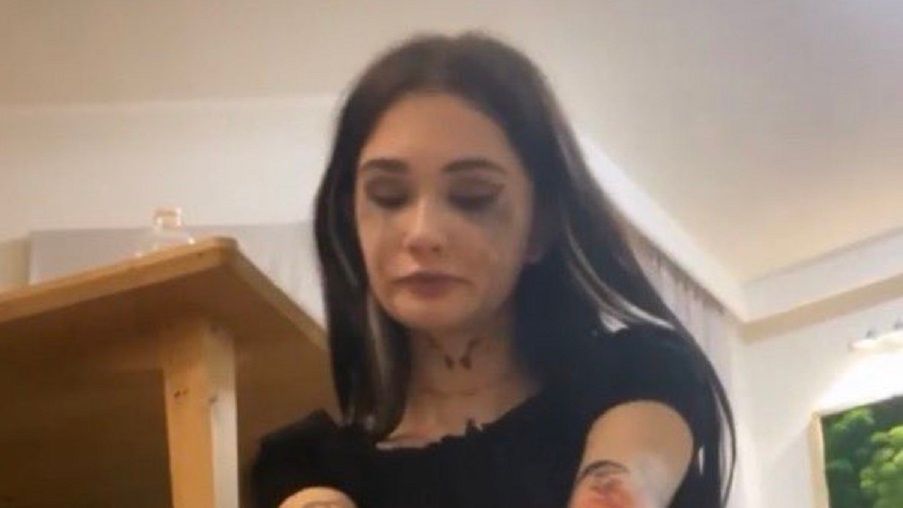 Nastoletnia instagramerka pocięła się w relacji na żywo. Co się stało z Queen of the Black? "To wołanie o pomoc"