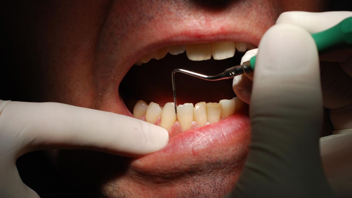 MZ rozważa zmiany w leczeniu stomatologicznym na NFZ. Szansa na lepszą jakość plomb