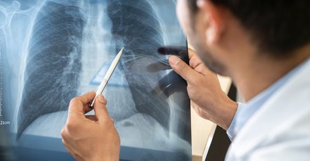Beryloza – przyczyny, objawy, diagnostyka i leczenie