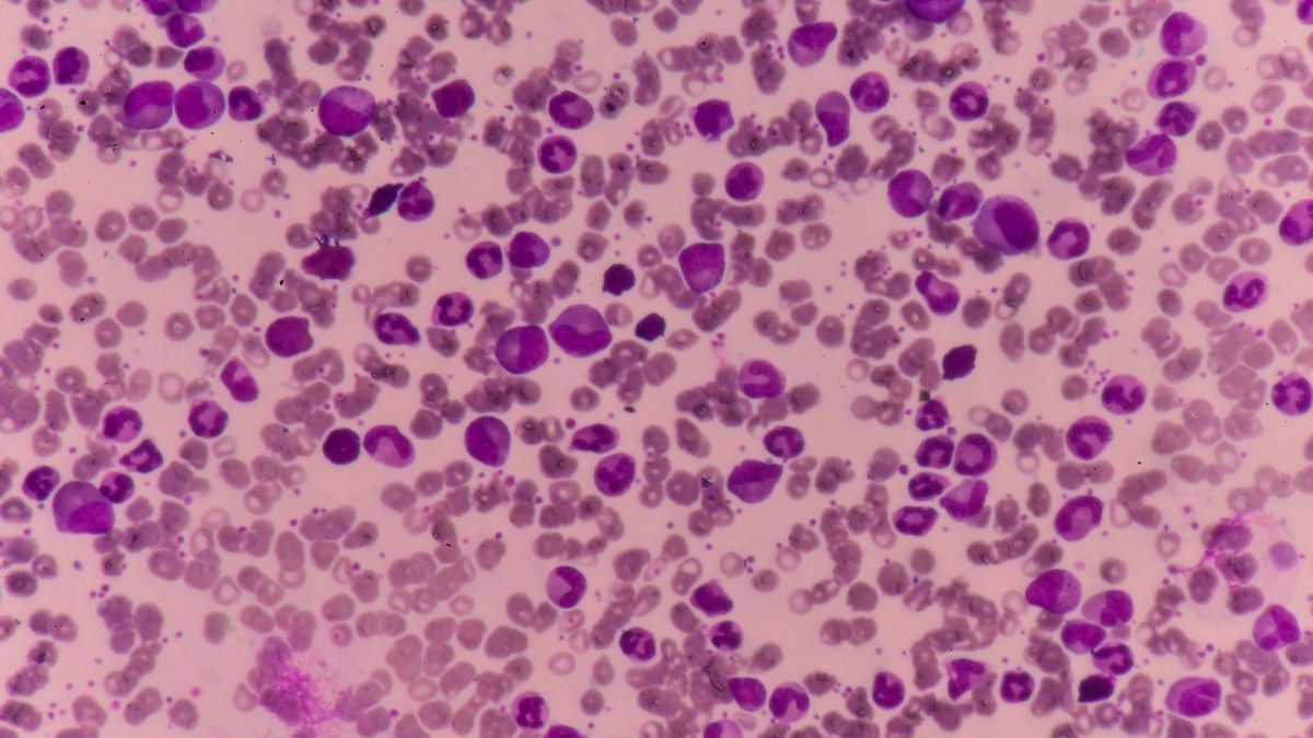 Bazofile. Kiedy powinniśmy określić ich ilość we krwi?