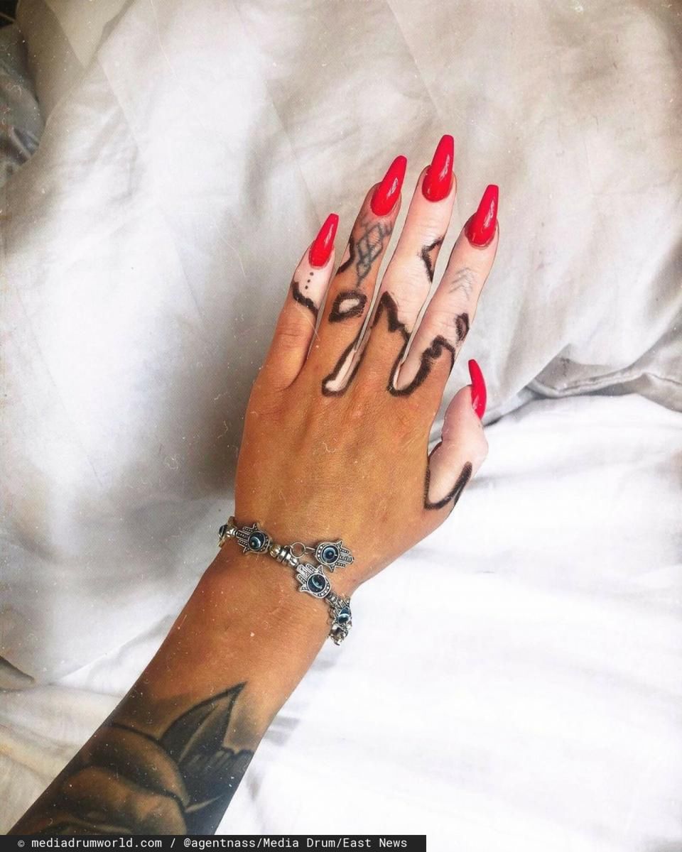 Anna chwali się swoim bielactwem