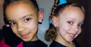 Bliźniaczki o różnych kolorach skóry. Jak wyglądają dzisiaj?