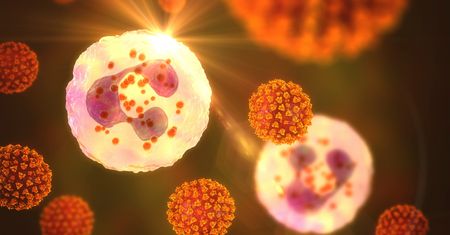 Neutropenia: objawy, przyczyny, stopnie i leczenie
