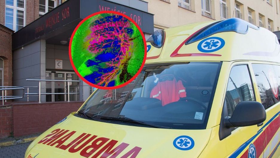 2-tygodniowy noworodek w śpiączce z powodu krztuścia. Choroba budzi coraz większy niepokój