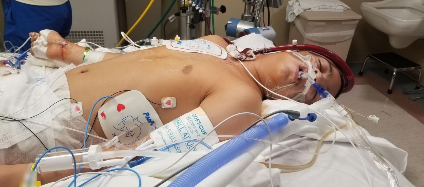 Zach walczył o życie