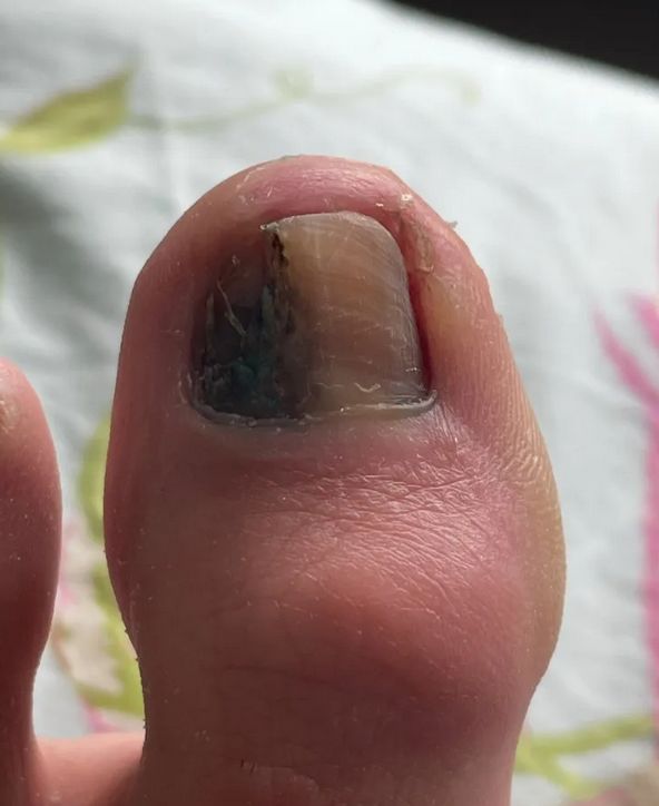 Początkowo zmiana nie wzbudziła niepokoju Laury