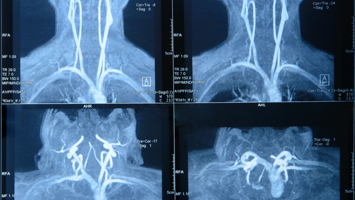 Rezonans magnetyczny szyi odbywa się w pracowni MRI