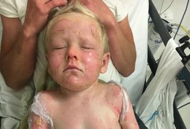Zabawa zakończyła się tragedią dla 4-latka. Spray do kąpieli dosłownie eksplodował