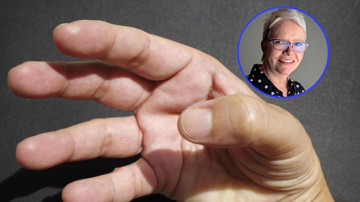 Prosty gest może wskazać problemy z naczyniami. Nie zastąpi jednak lekarza