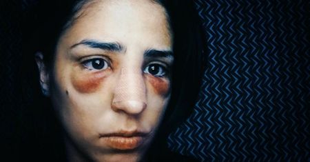 Leki antydepresyjne wywołały silne uczulenie. 29-latka została wprowadzona w śpiączkę