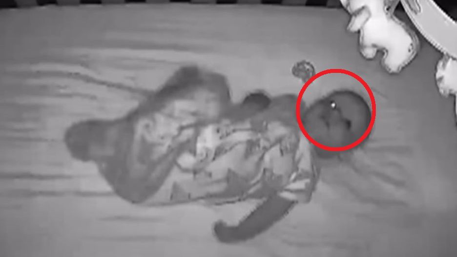 Oko jej dziecka dziwnie wyglądało na monitorze. W szpitalu usłyszała wstrząsającą diagnozę