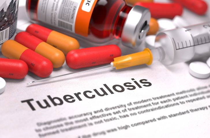 Próba tuberkulinowa i jej odczyt pozwalają wykryć czy organizm wykształca reakcję ochronną na bakterię powodującą gruźlicę