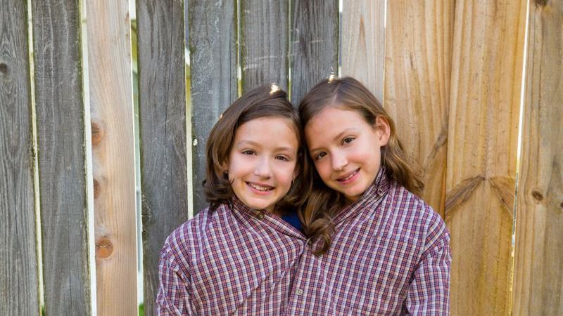 Bliźnięta syjamskie