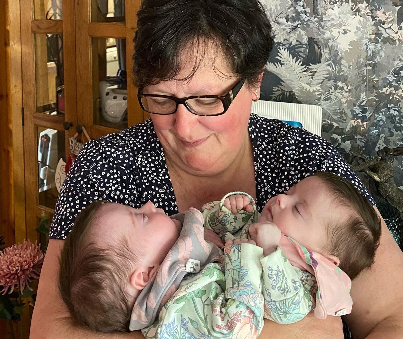 Urodziły się ze wspólną wątrobą, jelitem i nogą