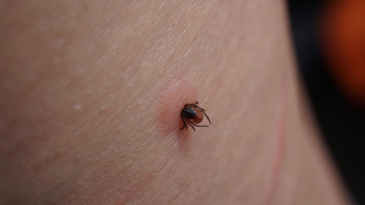 Ceroxim wykorzystuje się w leczeniu wczesnej postaci boreliozy.