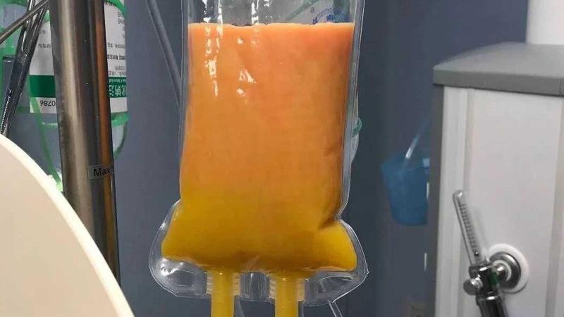 Tłuszcz z przefiltrowanej krwi kobiety