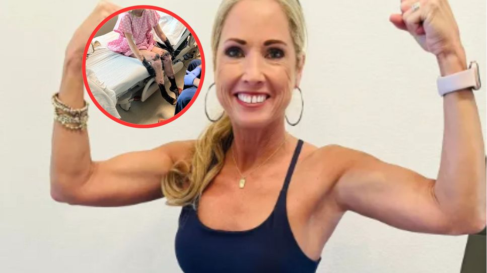 51-latka zakaziła się paciorkowcami. Teraz ostrzega