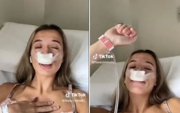 Napisała, że przeszła operację nosa dla dziecka