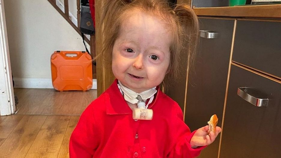 Dziewczynka jak z przypadku Benjamina Buttona. To jedyny taki przypadek na świecie