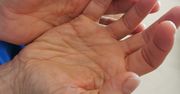 Masz taki palec? Znak ostrzegawczy, który wysyła ciało, gdy zaatakowała cukrzyca