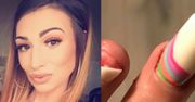 Prawie straciła cały paznokieć przez nielegalny klej do tipsów. Dziś przestrzega inne kobiety